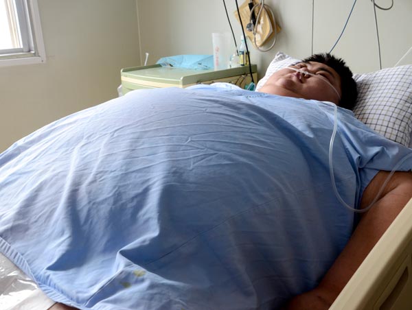 中国第一胖22岁男子去世 敲响肥胖警钟 中国第一胖22岁男子去世 敲响肥胖警钟