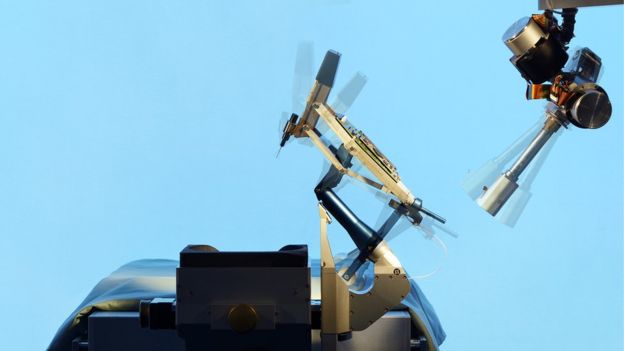 全球首例机器人眼内操作手术成功 全球首例机器人眼内操作手术成功