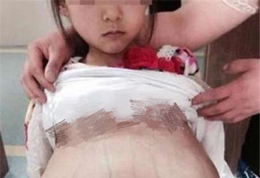 12岁走私女孩受孕,当局展开调查 12岁走私女孩受孕,当局展开调查