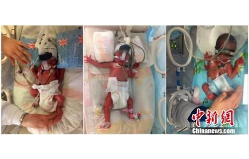 匪夷所思!女子产下一名男婴7天之后再生下一对双胞胎! 匪夷所思!女子产下一名男婴7天之后再生下一对双胞胎!