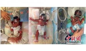 匪夷所思！女子产下一名男婴7天之后再生下一对双胞胎！